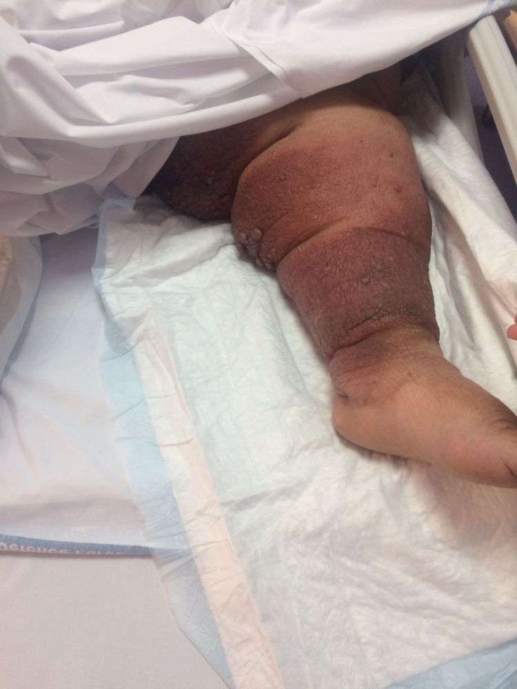 وزنها 200 كيلو وأنهكها المرض.. فهل من منقذ؟