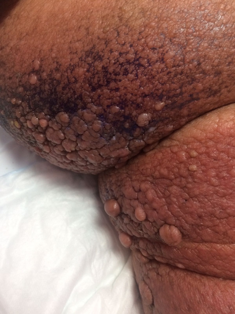 وزنها 200 كيلو وأنهكها المرض.. فهل من منقذ؟