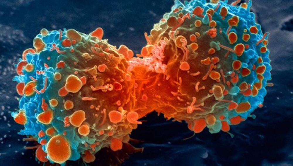 علماء يقترحون الجوع للقضاء على السرطان