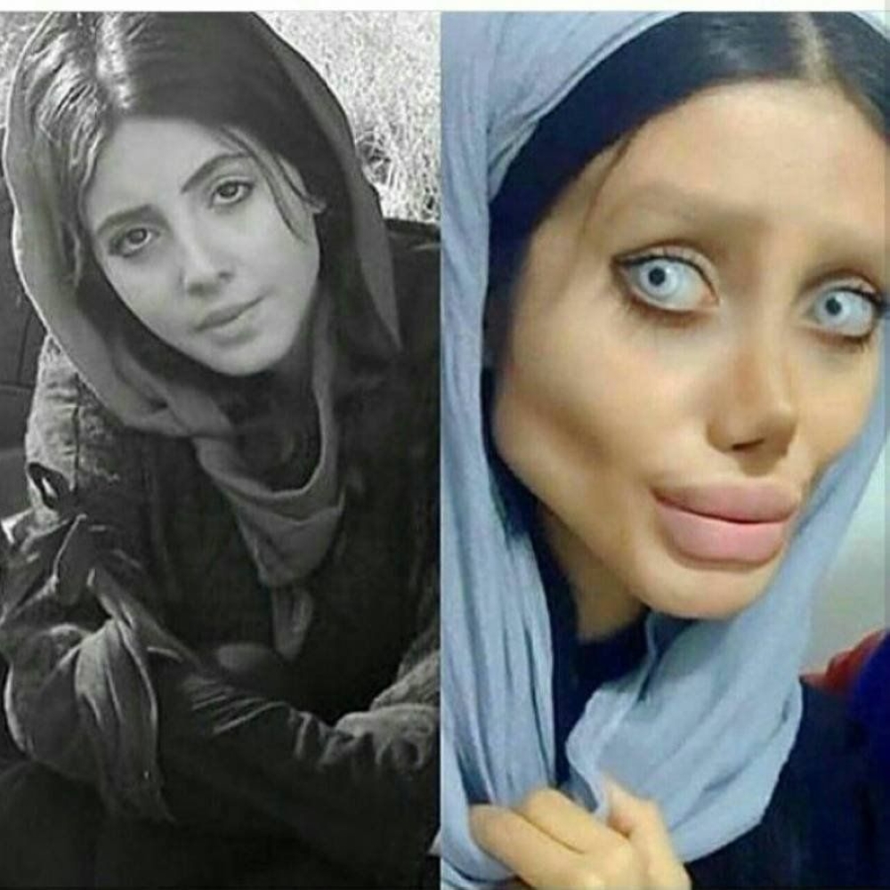 50 عملية تجميل كي تبدو مثل أنجيلينا جولي