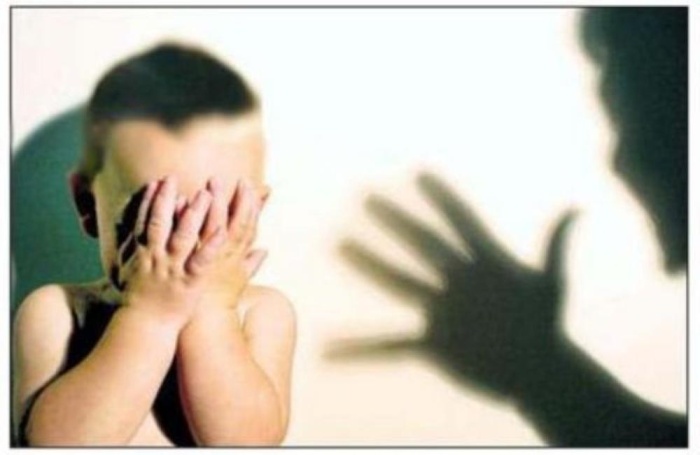 اختصاصية: صفع الطفل قد يؤدي لشلل نصفي