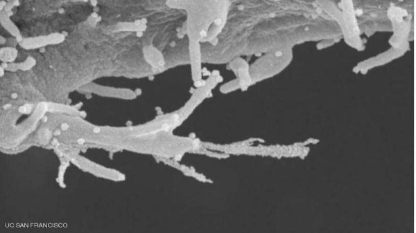 دراسة: فيروس كورونا يهاجم خلايا الجسم مثل "الزومبي"