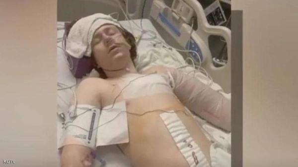 طفل مريض عقليا.. طلبت أمه المساعدة فأطلقت عليه الشرطة النار