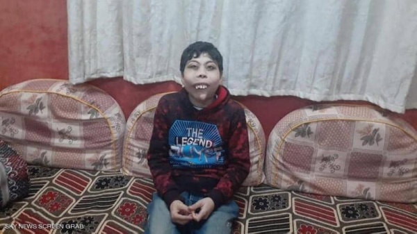 الحكومة المصرية تتكفل بعلاج طفلي المرض النادر