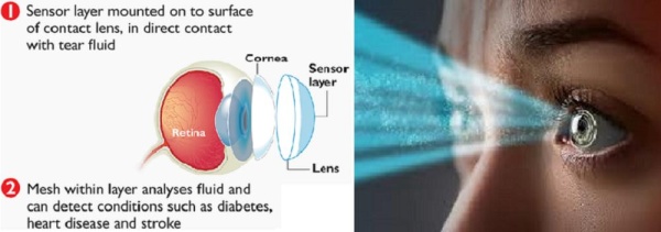ثورة طبية في عدسة لاصقة طورها علماء من جامعات 3 دول
