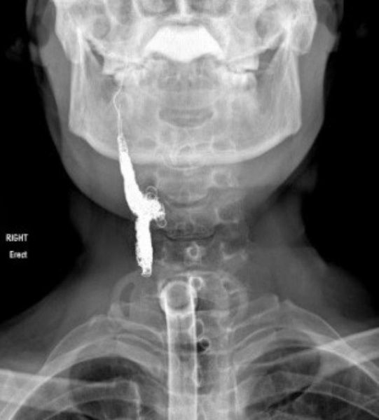 "حمد الجامعي" في تصريحات خاصة لـ"الوطن": إنقاذ حياة مريض بسرطان الحنجرة