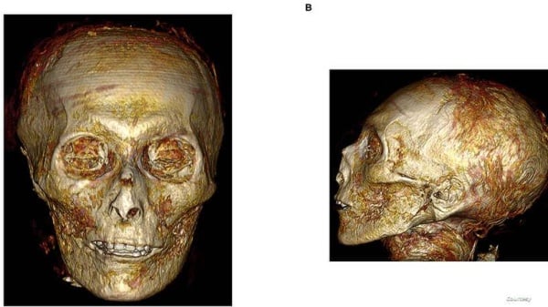 تقنية تكشف معلومات مثيرة عن ملك فرعوني