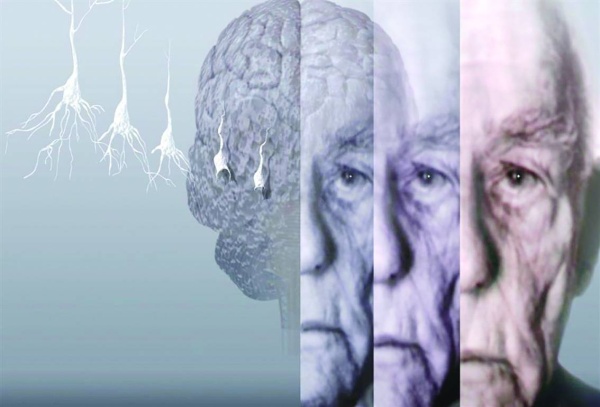 فاطمة صفوت: الزهايمر ليس مرحلة طبيعية للشيخوخة.. والإصابة تزداد مع تقدم العمر