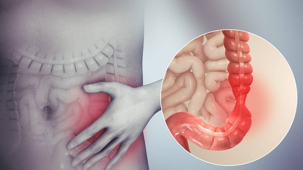 علامات تحذيرية تنذرك بوجود مشاكل في الأمعاء