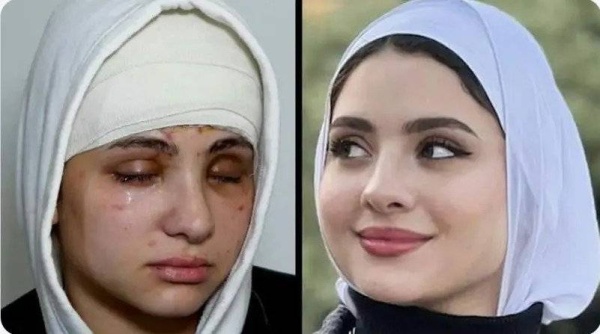 فقدت بصرها.. حادث مروع لبلوغر أزياء يشغل المصريين