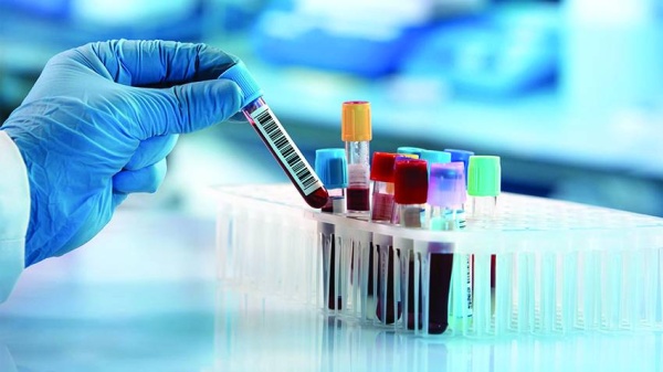 12 تحليل دم يجب إجراؤها سنوياً