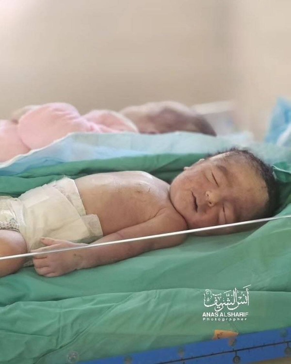 فلسطين.. ارتفاع عدد الأطفال المتوفين بسبب سوء التغذية في غزة إلى 16