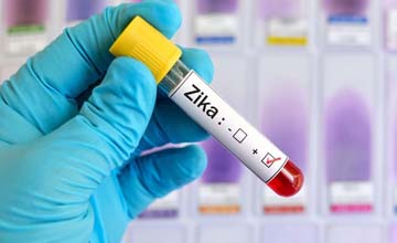 زيكا يصيب 136 شخصاً في فيتنام