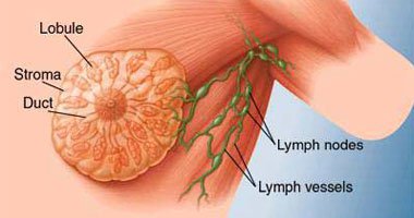 طريقة الفحص الذاتى لأورام الثدى وموعده