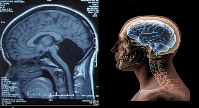 علماء يبتكرون مخا مصغرا بواسطة طابعة ثلاثية الأبعاد