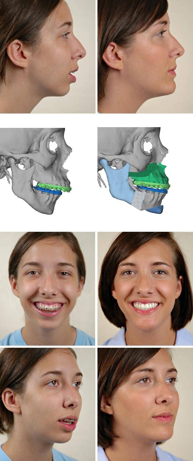 قحطان لـ الوطن: البحرين مرشحة لتكون أول دولة في العالم خالية من مرضى التقويم الجراحي