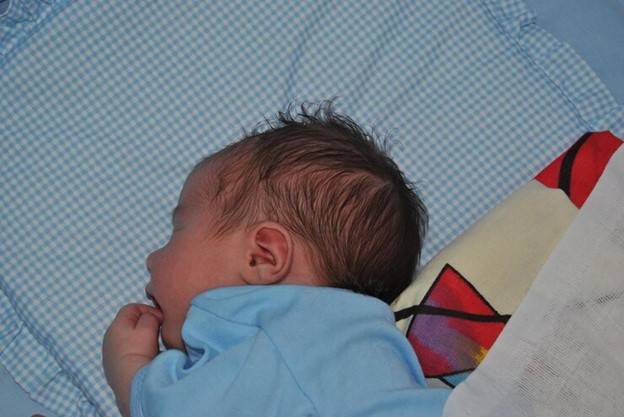 أسباب إصابة حديثي الولادة بالصفراء وطريقة العلاج