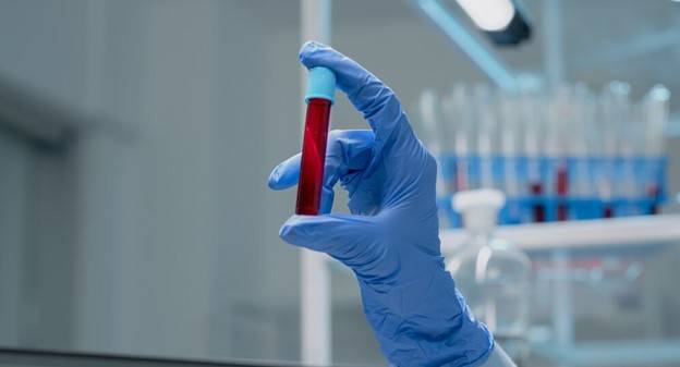 كل ما تريد معرفته عن اختبار سرعة الترسيب في الدم