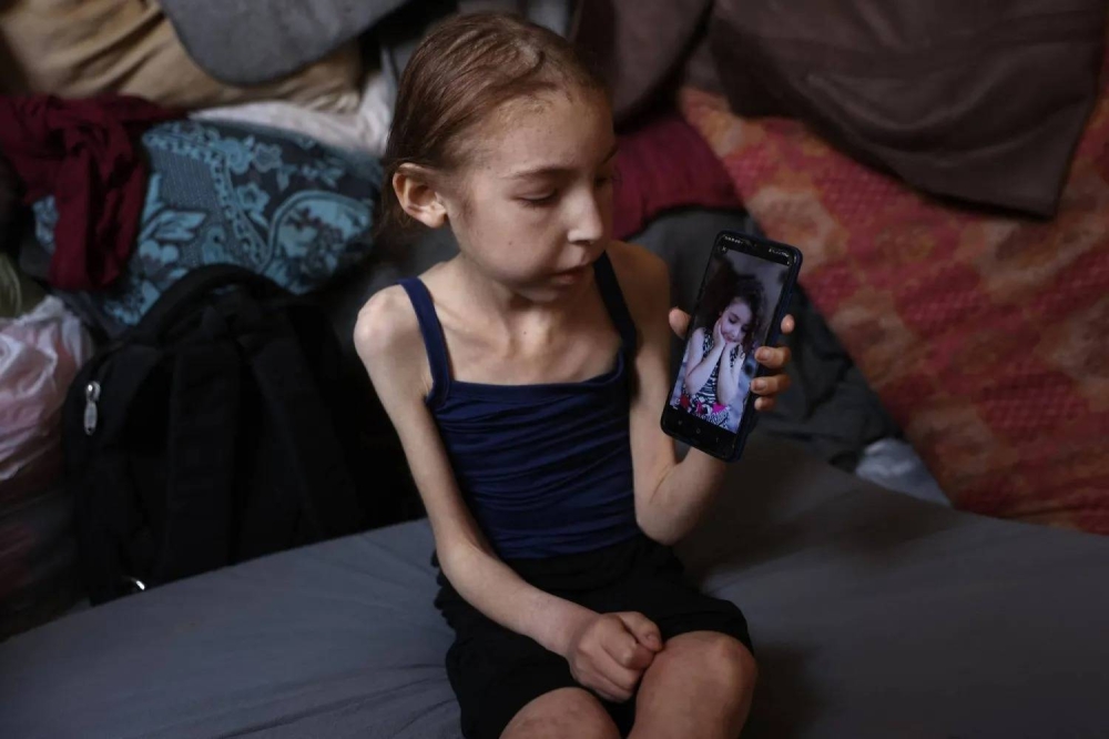 على حافة الموت... الجوع يفتك بأطفال غزة وسط تفاقم سوء التغذية