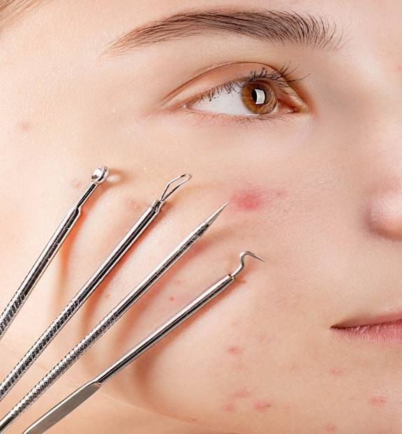 هل استخدام أجهزة إزالة الرؤوس السوداء آمنة؟