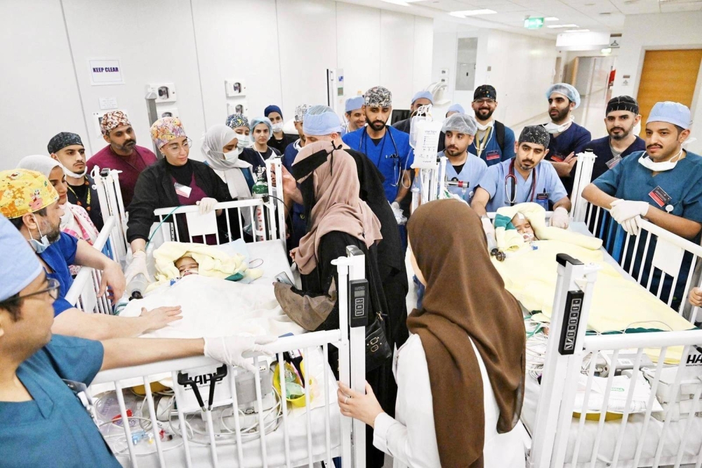 السعودية : نجاح فصل التوأم الملتصق الإريتري &laquo;أسماء وسمية&raquo; بعد عملية جراحية دقيقة