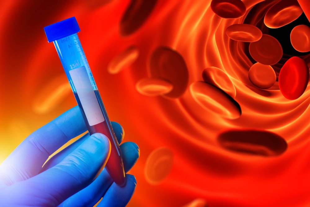 تقنية يابانية لرصد تخثر الدم دون تدخل جراحي