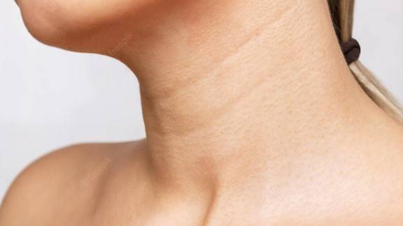 طرق فعالة للتخلص من خطوط الرقبة