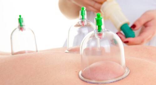 الحجامة.. علاج طبيعي يحسن صحة المدخنين ويساعدهم على الإقلاع