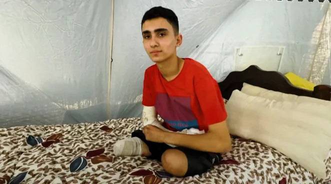 القصف الإسرائيلي يفقد لاعب جمباز ساقيه ويقتل حلمه في غزة