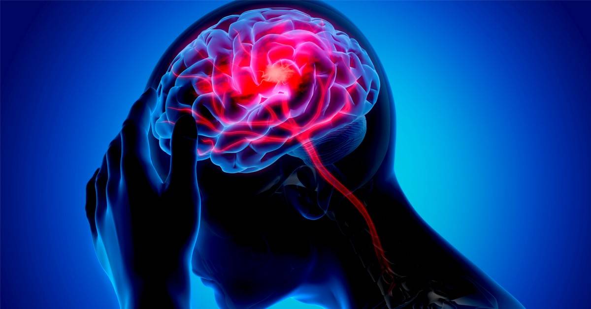 نزيف الدماغ الداخلي.. الأسباب والأعراض وطرق الوقاية