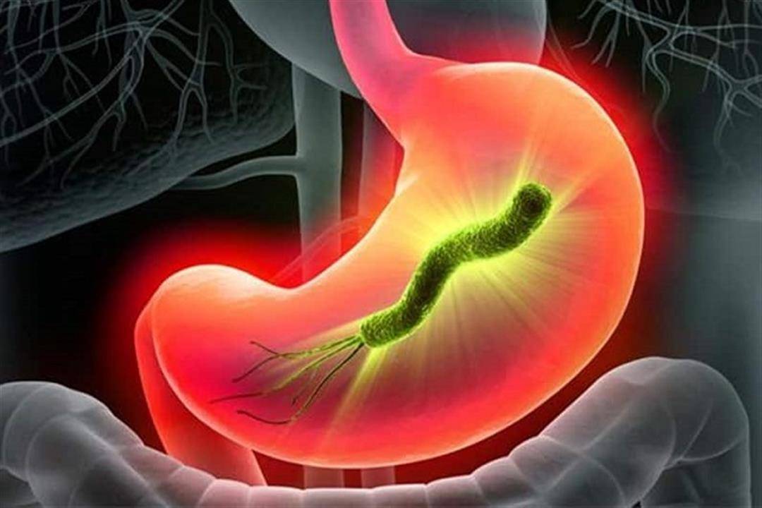 أسباب الإصابة بـ جرثومة المعدة وطرق الوقاية والعلاج