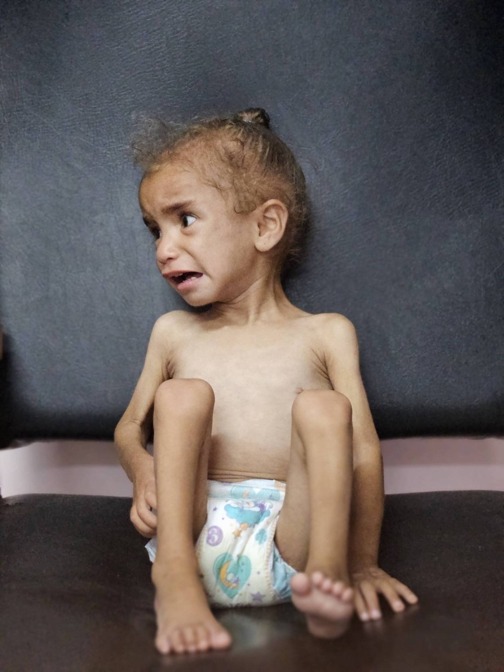 غزة أكثر الأماكن جوعاً على وجه الأرض