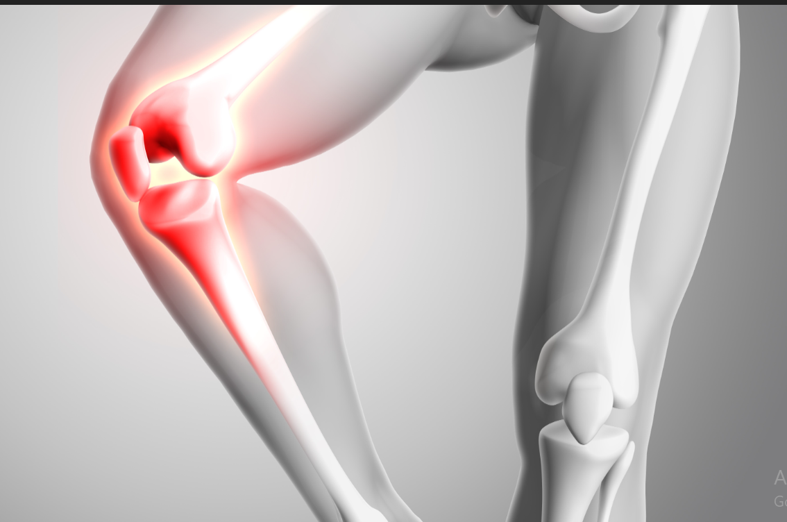 ما هي خشونة الركبة؟ وكيفية التعايش معها