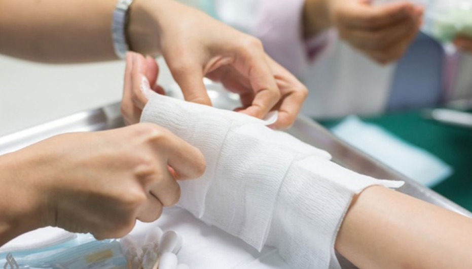 علماء يطورون دواء لتسريع التئام الجروح الناتجة عن الحروق