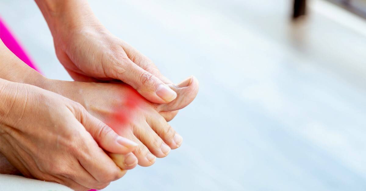 ما هو النقرس؟ المخاطر والأعراض وطرق العلاج