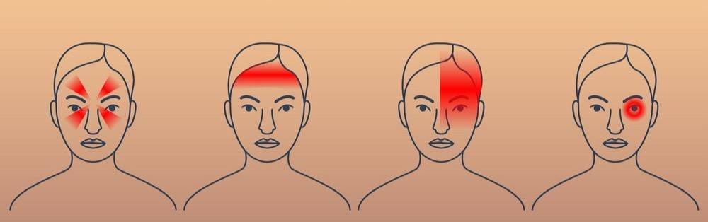 أنواع الصداع.. ومتى يكون خطيرًا ويستدعي زيارة الطبيب؟