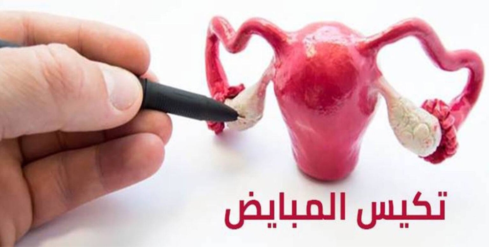 كل ما تريدين معرفته عن تكيس المبايض.. من اضطراب الهرمونات إلى العلاج