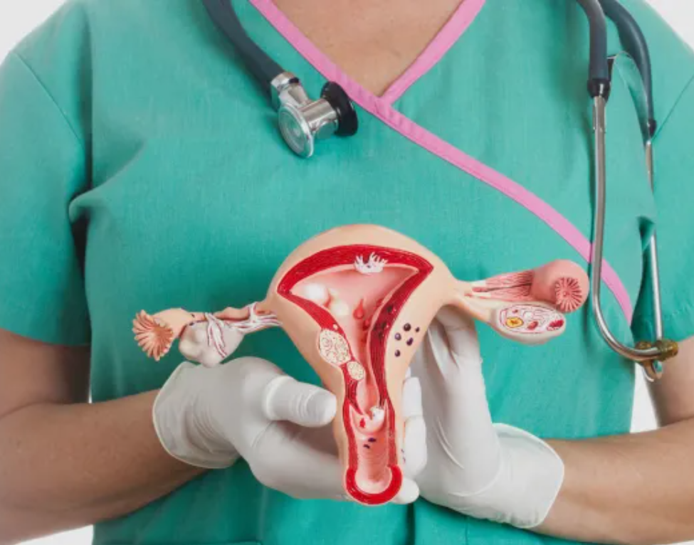 كل ما تريدين معرفته عن تكيس المبايض.. من اضطراب الهرمونات إلى العلاج