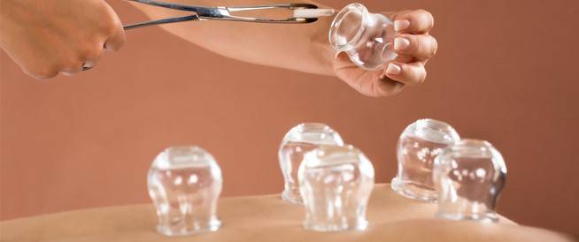 ما هي فوائد الحجامة للرجال والنساء؟