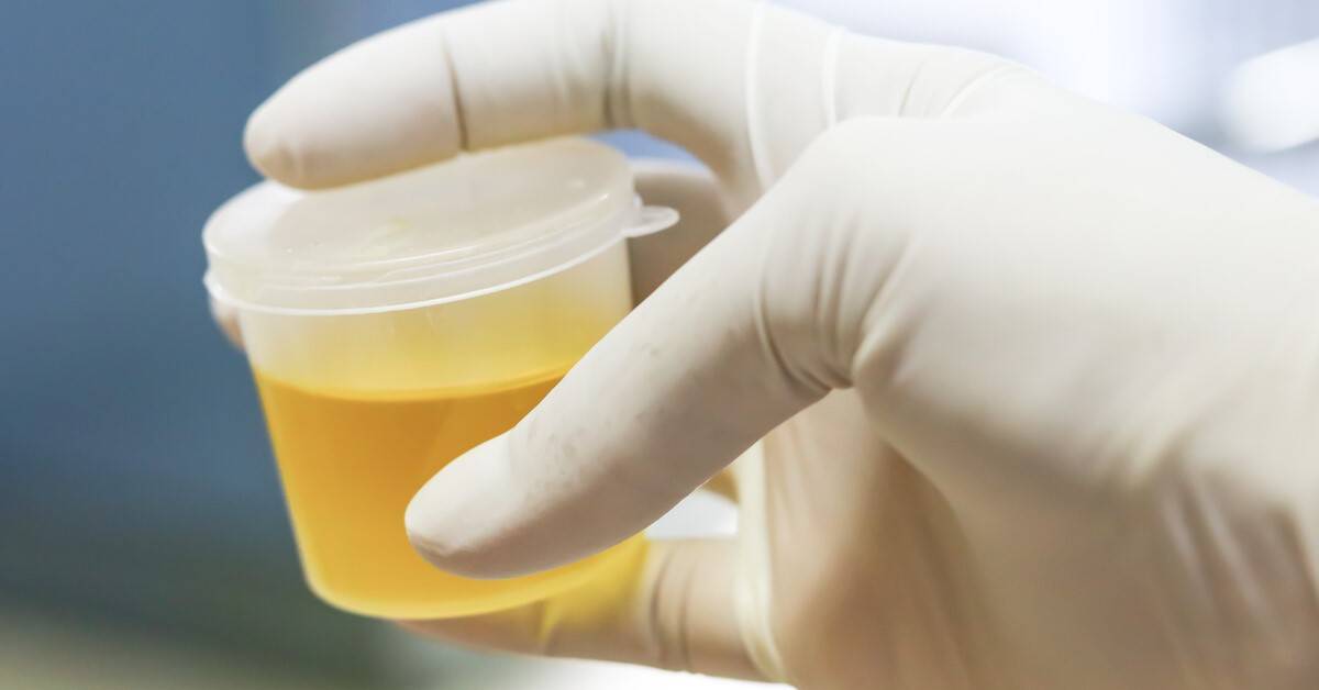 ما هي أسباب رائحة البول الكريهة؟ ومتى نلجأ للطبيب؟