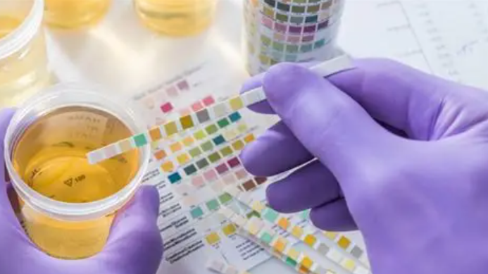 ما هي أسباب رائحة البول الكريهة؟ ومتى نلجأ للطبيب؟