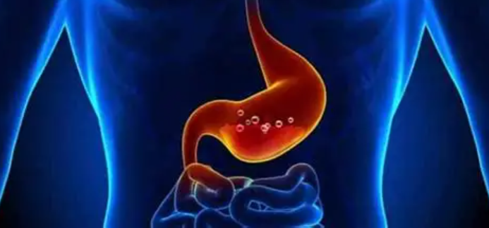 ما هو أفضل علاج للحموضة؟