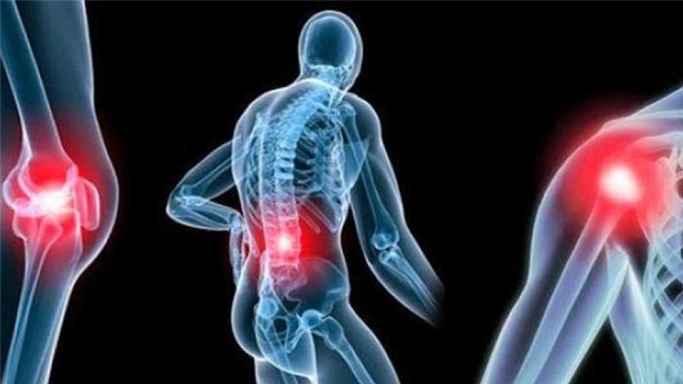 كيف يُعالج الروماتيزم؟.. دليلك الكامل لفهم أسبابه وأعراضه
