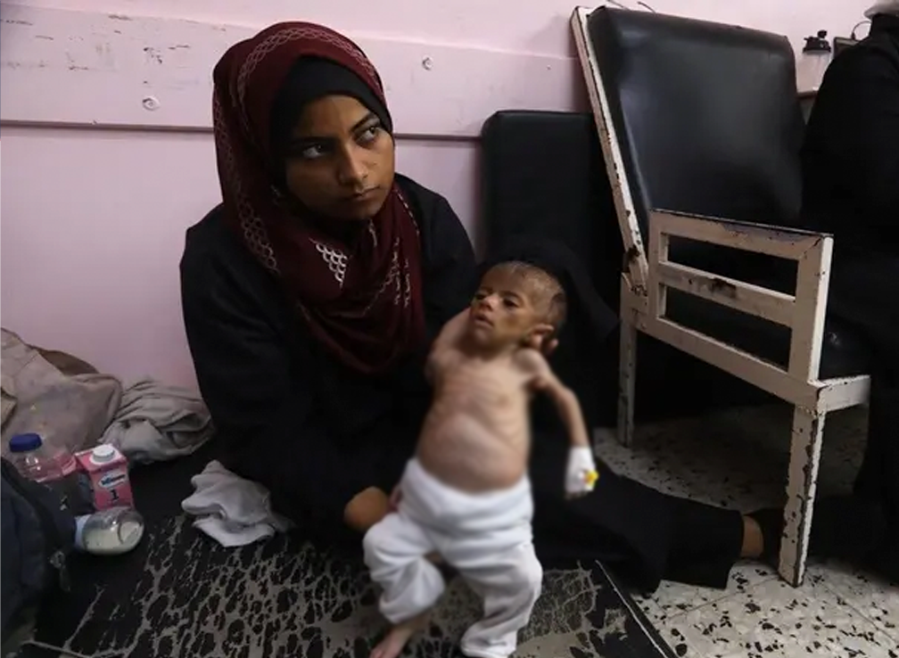 &laquo;الأغذية العالمي&raquo;: سوء التغذية في تزايد حادّ وثلث سكان غزة &laquo;لا يأكلون لأيام&raquo;