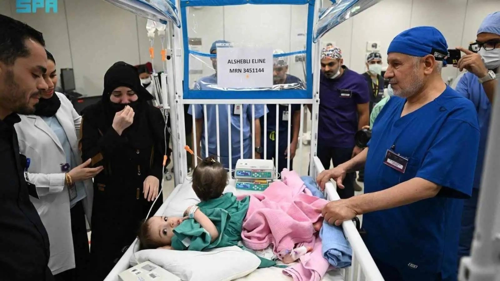 السعودية: نجاح عملية فصل التوأم السوري &laquo;سيلين وإيلين&raquo; بالرياض