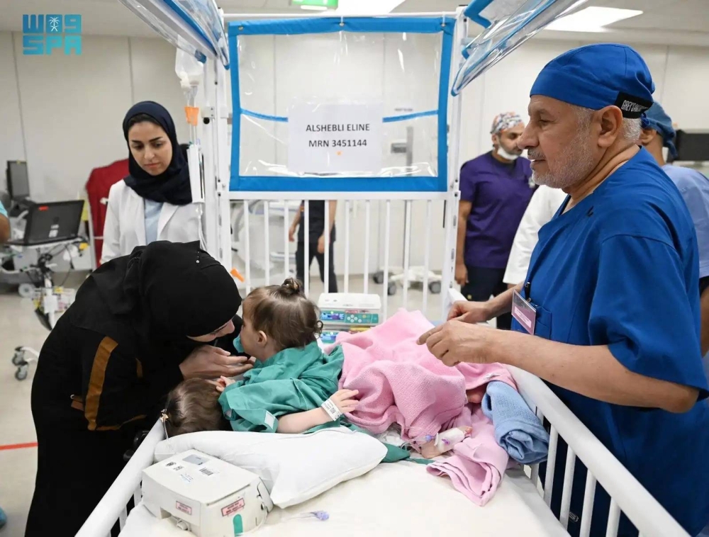 السعودية: نجاح عملية فصل التوأم السوري &laquo;سيلين وإيلين&raquo; بالرياض