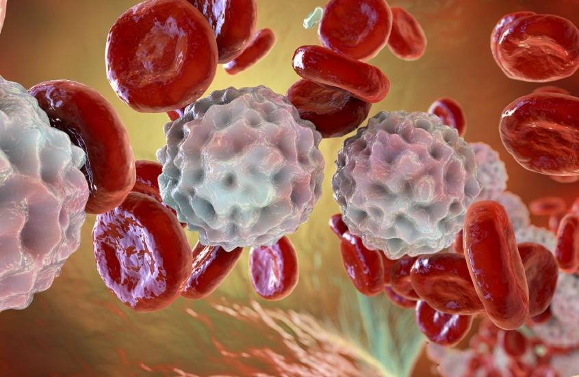 بجمع عقارين..علاج واعد لأحد أخطر أنواع سرطان الدم