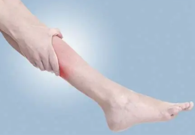 جلطة الساق.. متي تكون خطيرة وما علاجها؟