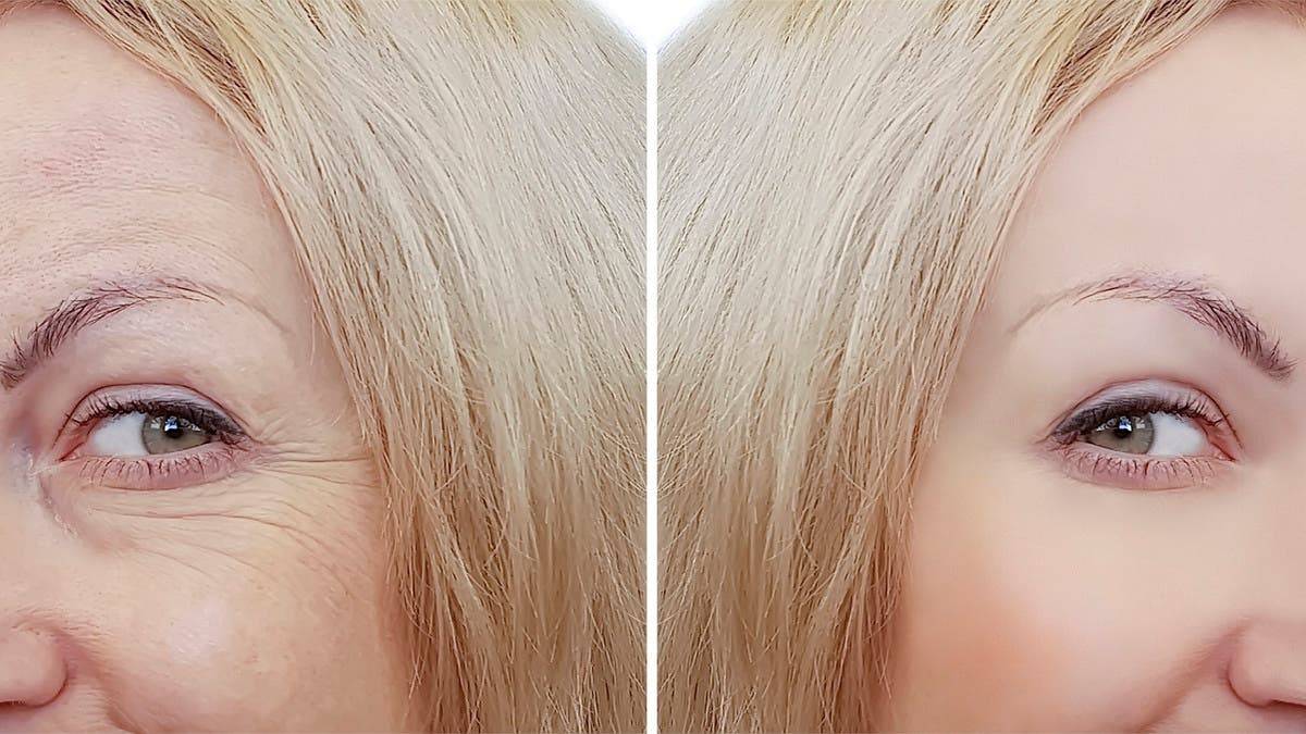 سر الشباب في طبقك.. 7 نصائح لزيادة الكولاجين طبيعيًا