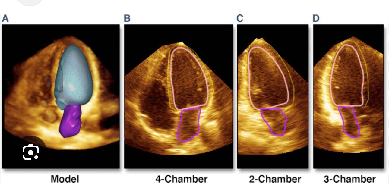 شيماء عبدالمعبود: الذكاء الاصطناعي يُحدث ثورة في تشخيص وعلاج أمراض القلب